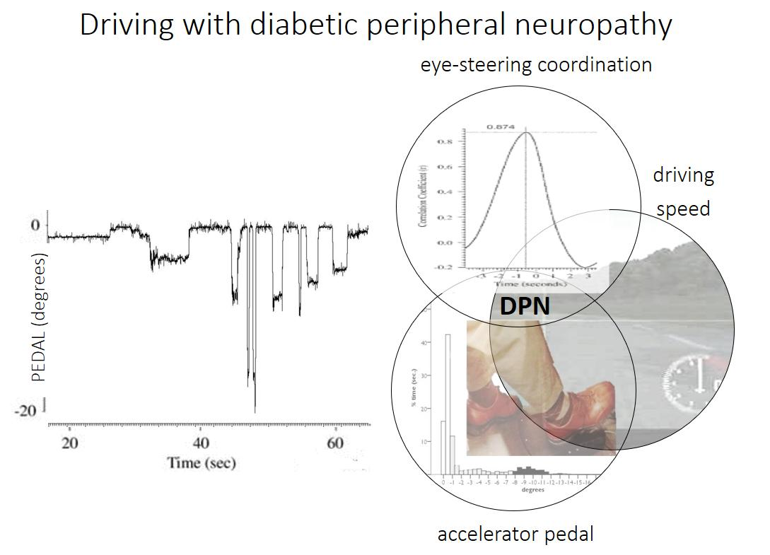 Our follow-up paper: #DiabeticPeripheralNeuropathy affects multiple aspects of driving. Drivers use the mid-range of the accelerator much less, steering & coordination are affected. Drivers sometimes have difficulty controlling the vehicle. #diabetes  sciencedirect.com/science/articl…