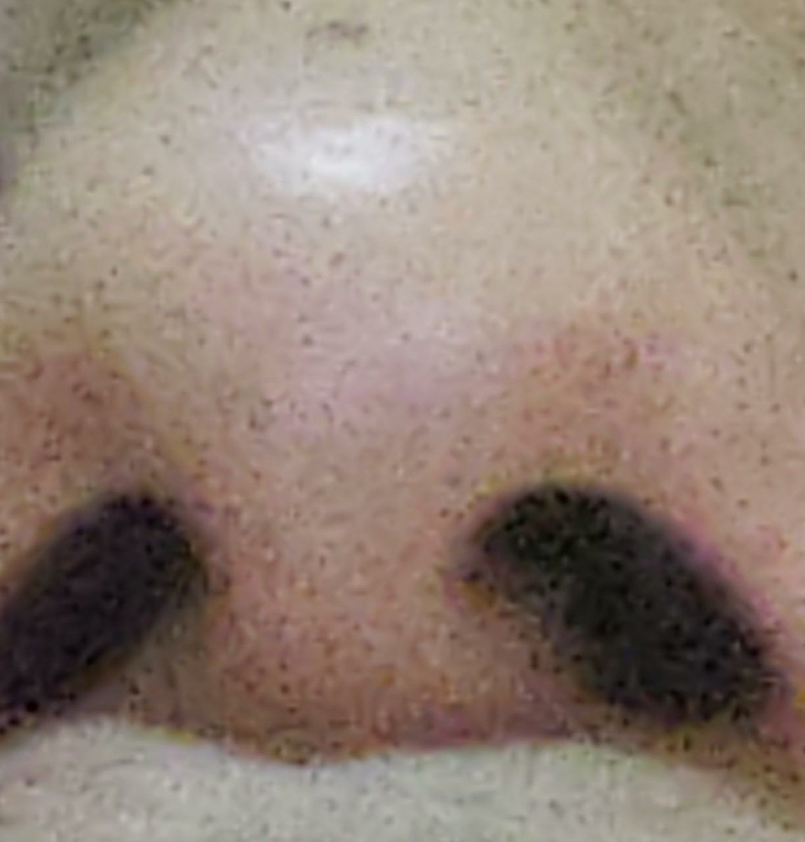 OfMslc's tweet photo. #teamnariz vs #teamcejas https://t.co/5NEkmTkRE6