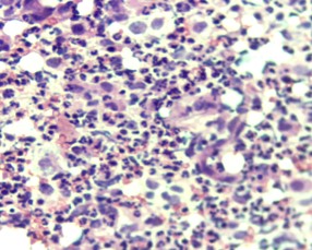 munaganuri08's tweet photo. Granulomatory Mastitis: A histological benign lesion with a malignant Radioclinical profile: About 3 Cases

https://t.co/2xlgiKpMVA https://t.co/cVTt3JZovQ