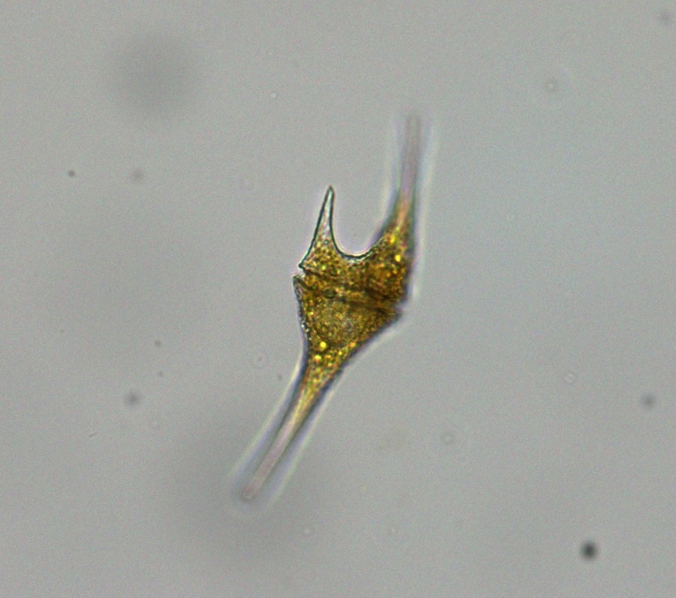 PhycoTechInc's tweet photo. #LakesAppreciation Month, Micro! Last up is a small forested pond in Coloma, Michigan, and comes in at just under an acre.  It has typically tannic water and lots of depth variability, which leads to some spectacular algae and zooplankton!  #supercoolalgae #supercoolzooplankton https://t.co/87G0fjF7uK