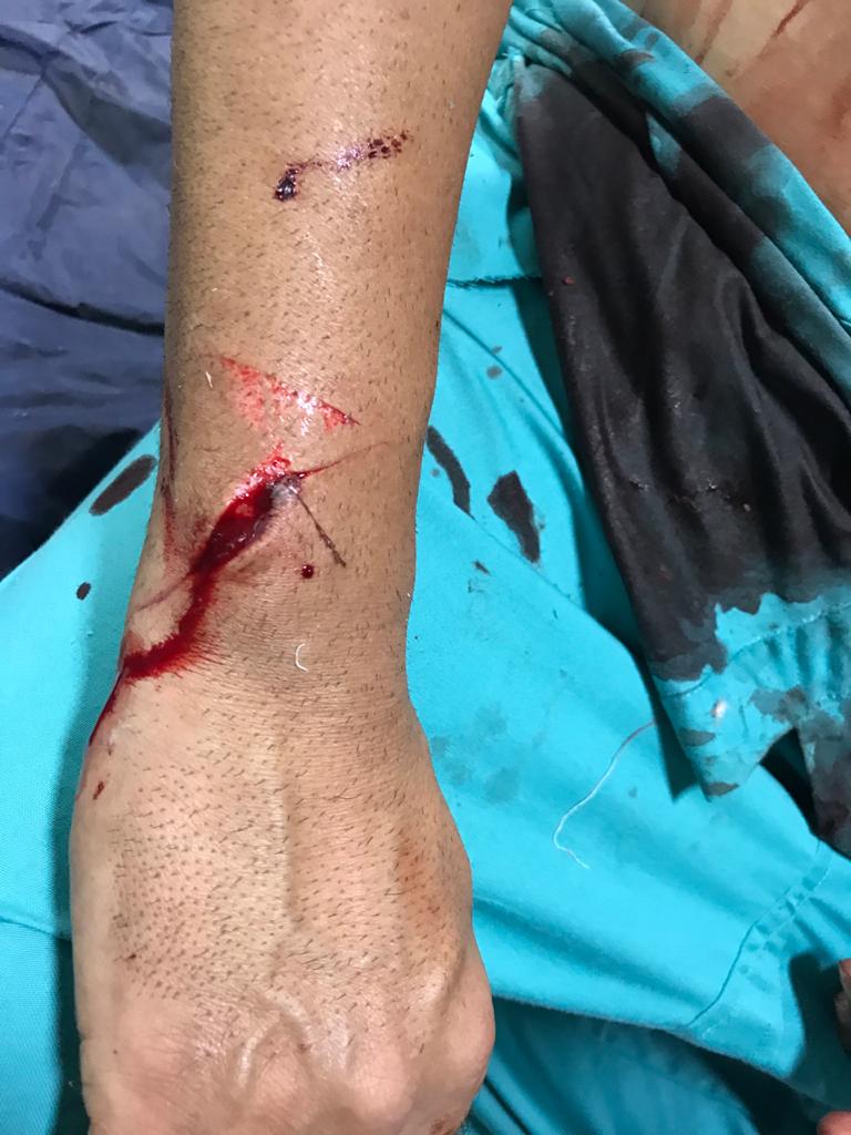 UnitedRda's tweet image. Dr Verma, physician Latur today assaulted by relatives of a COVID patient. Black day for medical fraternity.