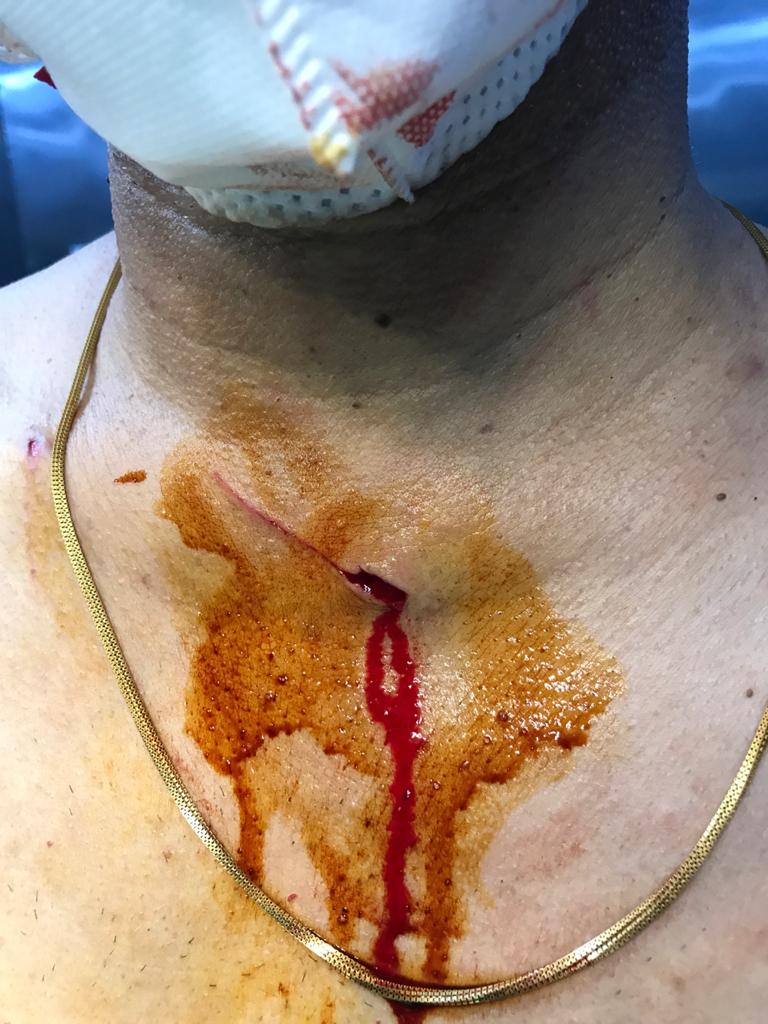 UnitedRda's tweet image. Dr Verma, physician Latur today assaulted by relatives of a COVID patient. Black day for medical fraternity.