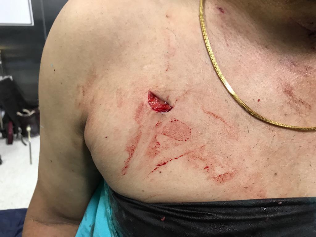 UnitedRda's tweet image. Dr Verma, physician Latur today assaulted by relatives of a COVID patient. Black day for medical fraternity.