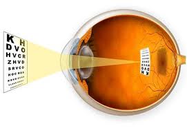 TheEyeGuys's tweet image. Myopia (nearsightedness)
If you can see objects nearby with no problem, but reading road signs or making out the writing on the board at school is more difficult, you may be nearsighted.

Learn about Myopia control here.
fishbaughfamilyeyecare.com/services/#myop…
#fishbaughfamilyeyecare