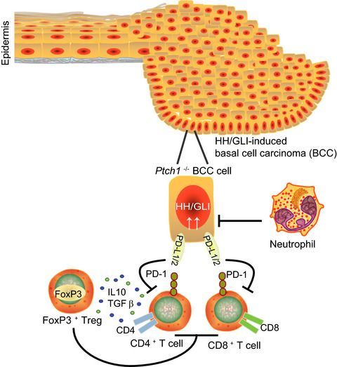 MolOncology's tweet photo. Now in Early View!
Epidermal activation of Hedgehog signaling establishes an immunosuppressive microenvironment in basal cell carcinoma by modulating skin immunity https://t.co/nJNR5hgREw
#skinimmunity #microenvironment #Hedgehogsignaling
Fritz Aberger & team @UniSalzburg https://t.co/IV3aEaeMYR