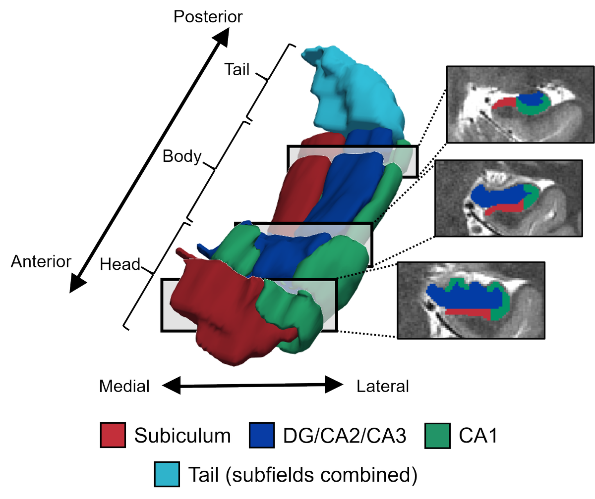 Delighted to share our review of hippocampal pattern similarity studies, written with the brilliant  @jess_robin_  @rosanna_olsen  @morganbarense and Morris Moscovitch. For a quick walk-through, thread below: https://www.sciencedirect.com/science/article/abs/pii/S0149763420304838