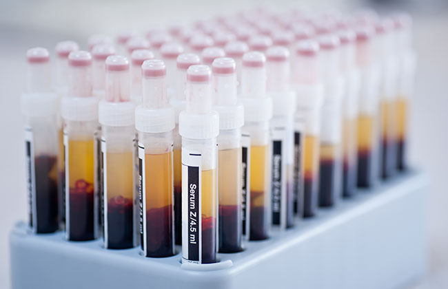 Did you know that #Ficoll® and #Polysucrose is two different names of the same chemical? We offer Polysucrose alone and coupled to fluorescent dyes such as TRITC and manufacture on demand.

lnkd.in/eQJD4FJ
linkedin.com/posts/tdb-labs…

#BuffyCoat #PBMCs #polysaccharides