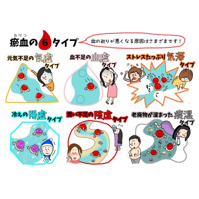 瘀血のtwitterイラスト検索結果 古い順 瘀血のtwitterイラスト検索結果 古い順