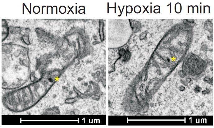 …but not, Ca2+ is already inside the mitochondrial matrix, in calcium phosphate granules that are dissolved in hypoxia and that release soluble Ca2+(remember that matrix is acidifed by complex I deactivation, and granules are dissolved in acid)10/n