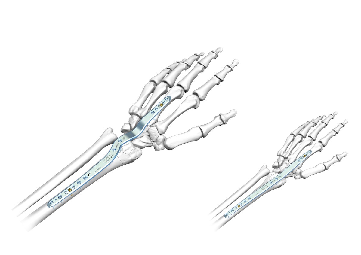 Medartis_Global's tweet photo. INGENIOUSLY CURVED. The new Wrist Spanning Plate 2.5 by #Medartis. Specific plate designs for 2nd and 3rd metacarpal treatments. Rethink distraction plating procedures.
https://t.co/OuPamauyip
#APTUSHand #APTUSWrist #IngeniouslyCurved https://t.co/rfw3sd0Y5I