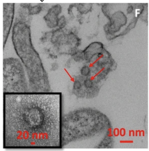 1) It's official: research that found infectious SARS-CoV-2 in air samples has been peer-reviewed: "significant environmental contamination in rooms where patients infected with SARS-CoV-2 are housed and cared for, regardless of the degree of symptoms"  @Prof_Lowe  @nature