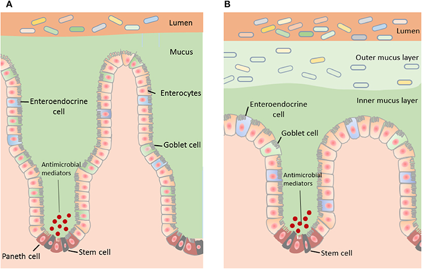 Crecimiento bacteriano excesivo en el intestino delgado