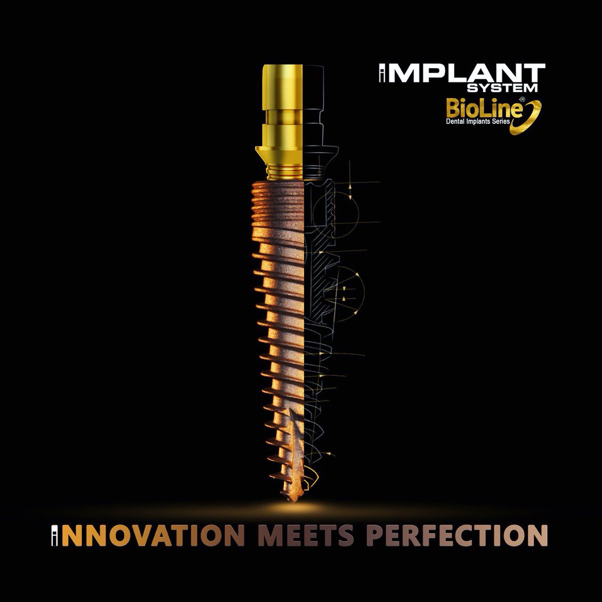 IBioline's tweet image. For all the Dental Implantologists, If they need an optimal graftless, 2 piece immediate loading prosthetic solutions for their patients !! BioLine welcome you to the world of iIMPLANT SERIES..#iimplant #bicorticalimplants #basalimplants