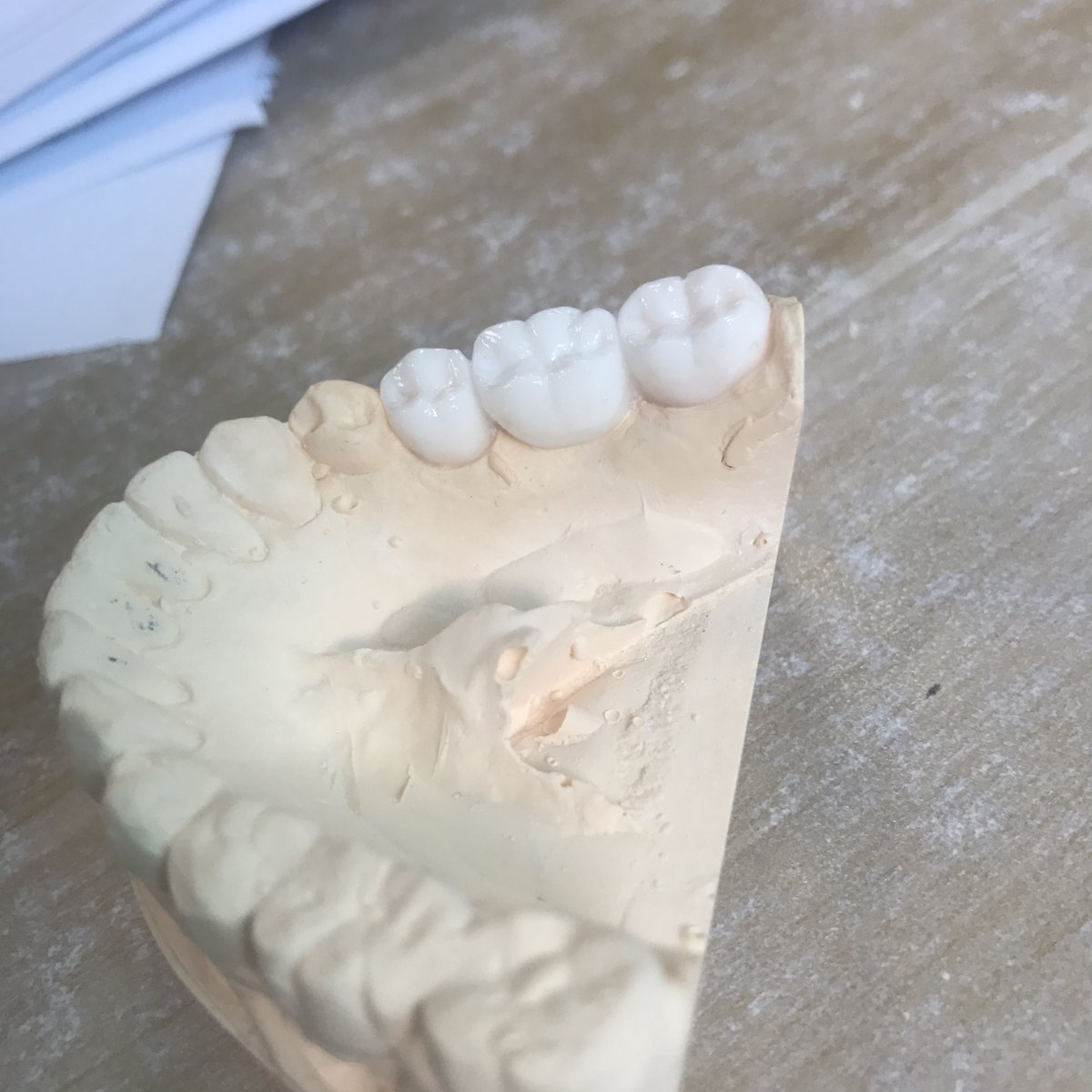 FullService_CDL's tweet photo. Wax up, very nice anatomy. Our quality is well received by our customers.
Waiting for your consultation for more details of the cooperation.
Email: mr.doczhang@gmail.com
WhatsApp:0086 18823711832 https://t.co/WAzyhfaGce
