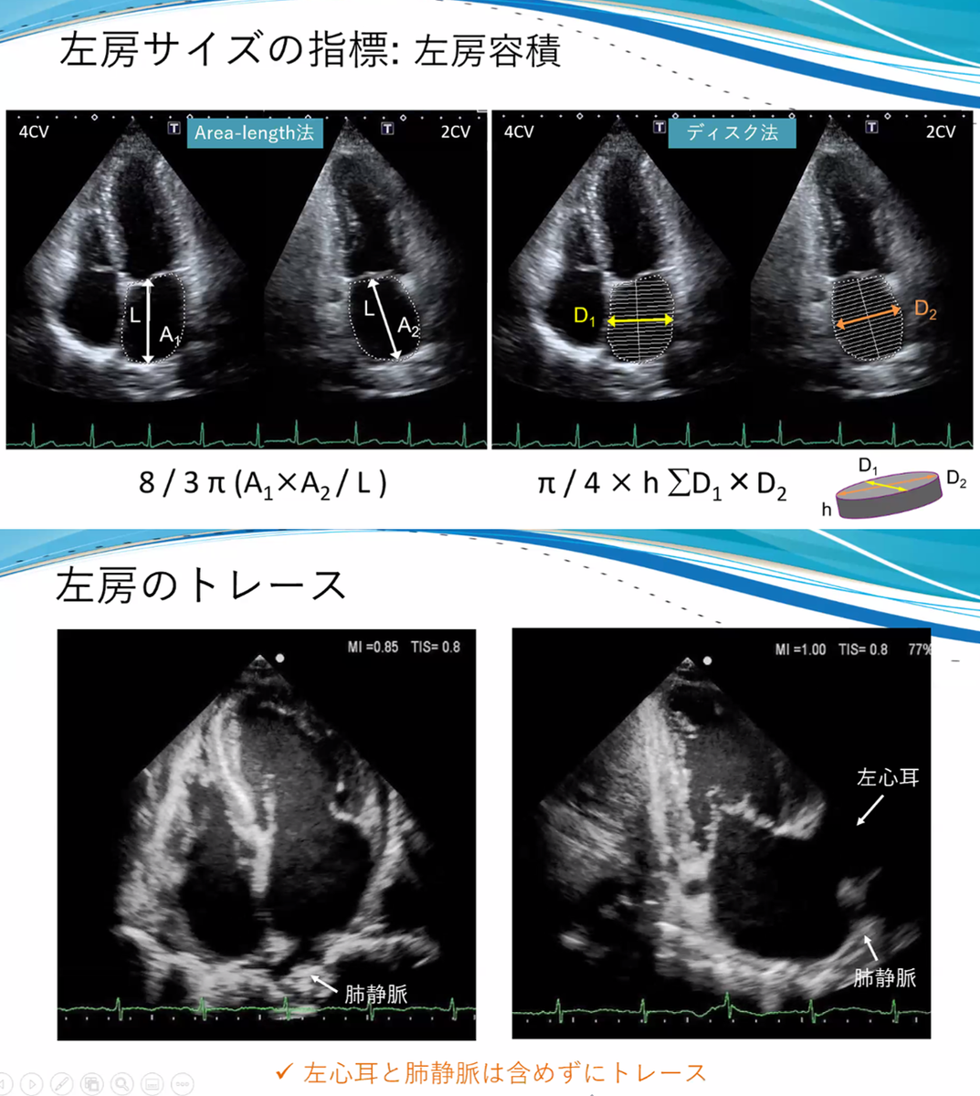20JCS チーム医療セッション シンポジウム 2 ガイドラインでは語り