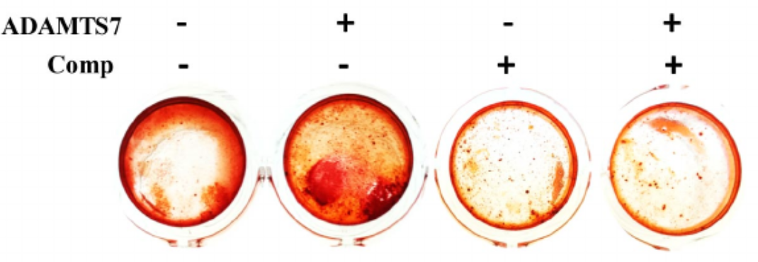 FEBSOpenBio's tweet photo. Hot off the press!
ADAMTS7 degrades Comp to fuel BMP2‐dependent osteogenic differentiation and ameliorate oncogenic potential in osteosarcomas https://t.co/whyqOvANJ5
#osteosarcoma #ADAMTS #metalloproteinase
Xuexiao Ma, Lu Zhang and colleagues at Affiliated Hospital @QingdaoU https://t.co/BNCYR60amU