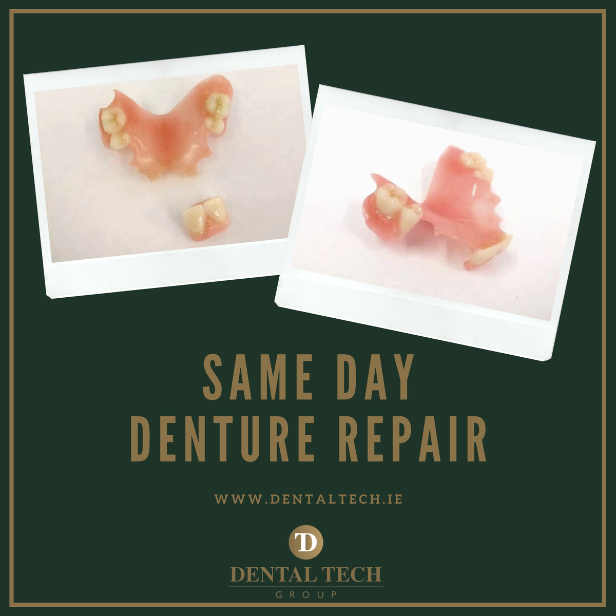 dentaltechgroup's tweet photo. Broken denture?
A distorted denture is impossible for a dental lab to repair!
Our in-house LAB provides a one-day service on repairs, or repair/reline procedures, so you can make arrangements to collect it the same day!
CALL 01 455 1866 NOW!
#denturerepair #dentaltechgroup https://t.co/mLaJ6Q13CW