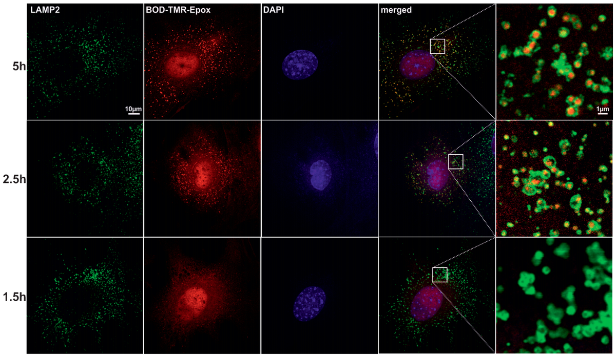molcellprot's tweet photo. "#Proteaphagy in mammalian cells can function independent of ATG5/ATG7" – #lysosome #proteasome #proteindegradation #autophagy
https://t.co/knAJO195jK
@UniBonn https://t.co/0TMuLmIiXg