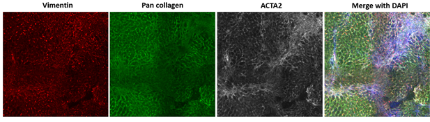 Visikol's tweet image. Check our recent blog post from Visikol Scientist Mei Fong Pang, PhD where she describes how Visikol Inc is using precision cut liver slices (PCLS) as an advanced in vitro model to study liver disease. 

hubs.ly/H0t3fDV0

#NASH #NAFLD #PCLS
