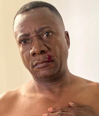 MariaNtusani's tweet photo. Urgent : Ngoyi Kasanji a été sérieusement tabassé à Kingakati suite à la fuite des décisions des réunions nocturnes qui s'y tiennent.

Joseph Kabila le soupçonne de traîtrise .

C'est pourquoi ces derniers temps il cherche à se rattacher par des tweets et positions anti-FATSHI. https://t.co/55H5BO6zRA