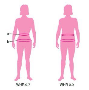 Your WHR is what truly will determine what results your surgeon will able to yield based on your anatomy .These (2) women can go to the exact same surgeon and have the exact same amount of fat removed and transferred. Their results will differ