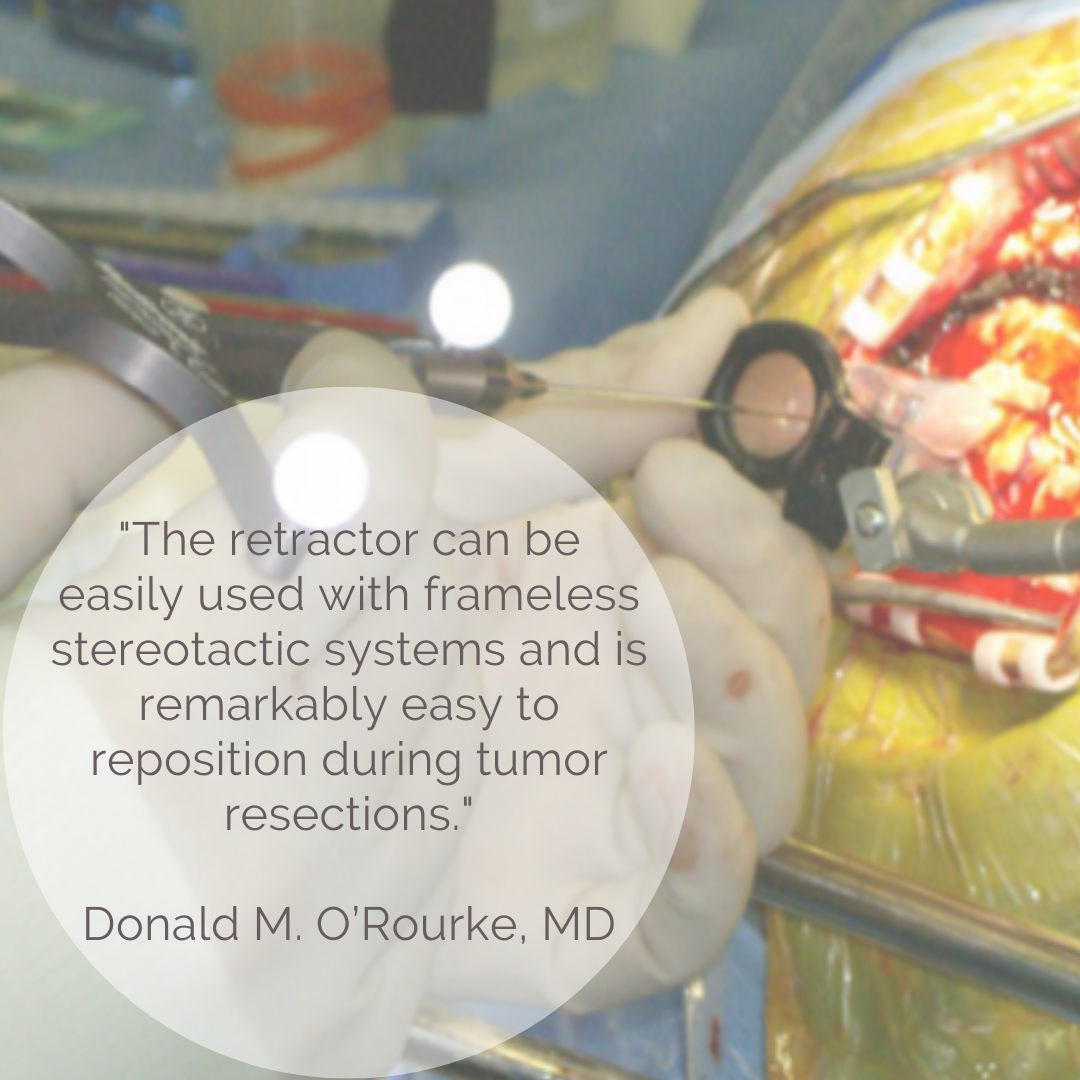 vycormedical's tweet photo. Dr. O’Rourke of the University of Pennsylvania likes that the VBAS accommodates IGS pointers for target accuracy and can be manipulated in all three directions, giving three degrees of freedom without further deformation of the surrounding brain #vycor #vycormedical #vbas #IGS https://t.co/IT2CjU8PFt