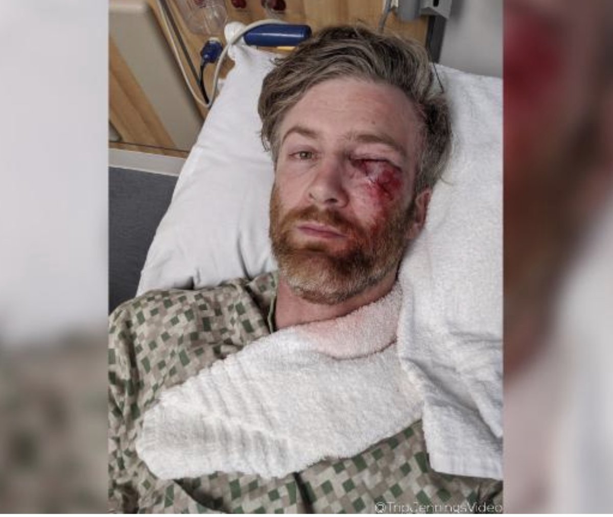 the fact that  @realDonaldTrump  @TheJusticeDept  @DHSgov  @CBP  @DHS_Wolf &  @HomelandKen <—both unlawfully in their  @DHSOIG positions? FVRA?this is NOT OKAY“I got hit right in the eye," Jennings told CNN, saying he suspects it was a pepper ball” https://www.cnn.com/2020/07/30/us/journalist-portland-protest-federal-agents-trnd/index.html?utm_medium=social&utm_content=2020-07-30T13%3A21%3A02&utm_source=twCNNi&utm_term=link