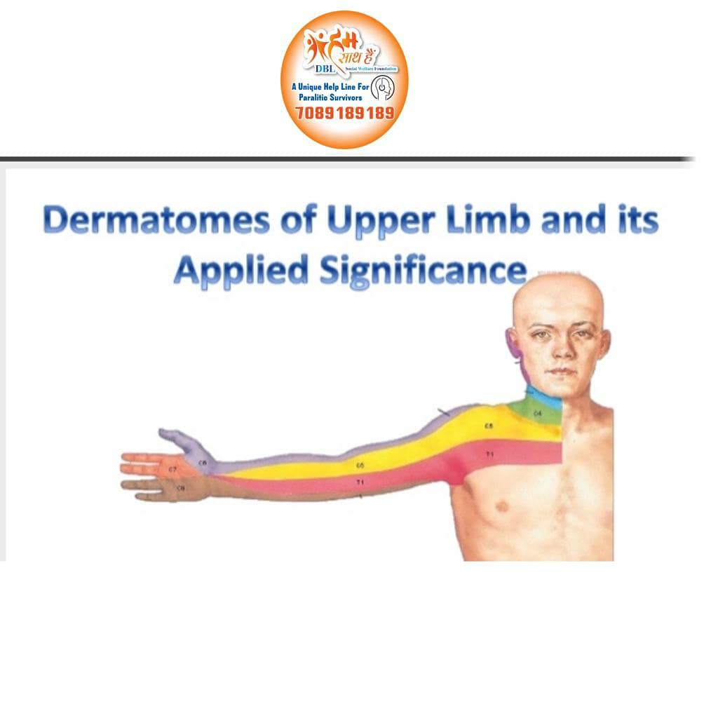 HaiSaath's tweet photo. #Dermatomes
#Upperlimb
#Appliedanatomy

Dermatome is an area of skin that is mainly supplied by a single spinal nerve.
Localise Neurologic level radiculopathy, compression of spinal nerve roots,Virus herpes Zoster infection
#HumSaathHai
#dblsocialwelfarefoundation
#physiodeptghmc https://t.co/oY8BqmDdgR