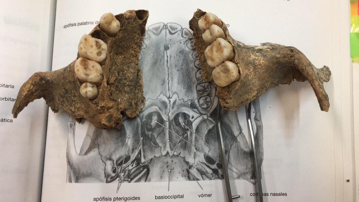 Analysing #theteeth of individuals from the #CopperAge of the #Northeast of the #IberianPeninsula in the Ca n'Oliver Museum in Cerdanyola del Vallès (Barcelona).