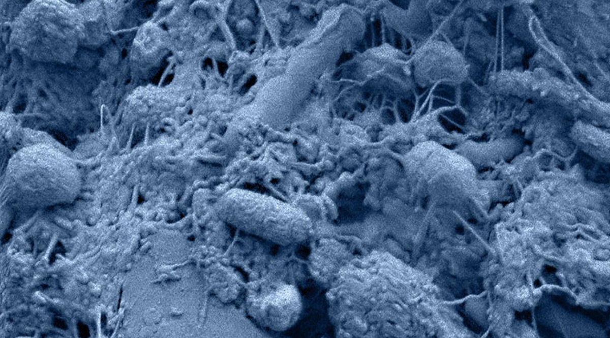 scisignal's tweet photo. The Jia, Jin, and Shao labs discover that both live and heat-killed #probiotics can substantially alter the composition of the brain #peptidome in mice. #HebeiUniversity #HostMicrobeInteractions https://t.co/k5fDLAKtC7
Credit: Dennis Kunkel Microscopy/Science Source https://t.co/e3E8kMjVrG