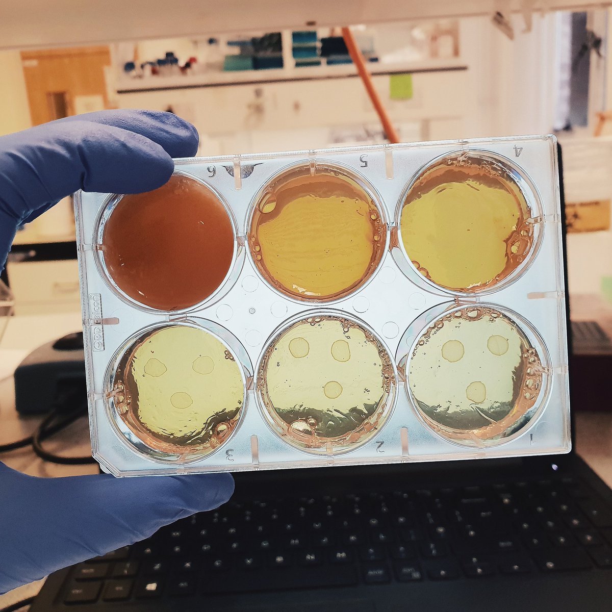 @SfAMtweets @CalJMarsh @jenniefrench95 @JamesJW90 @Nicky_lab_brat @Bam_and_Sheep @PenkovaElitsa @_JakeBell1 @lucas_walker92 Catechins inhibiting MRSA growth in TSB 👩🏼‍🔬🦠