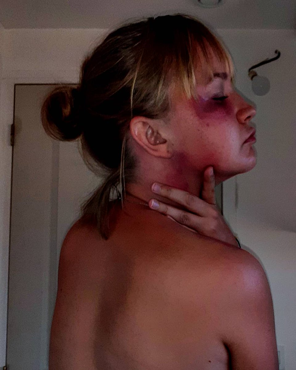 AnnabelVerdru's tweet photo. J'ai postulée ces photos et ce texte hier sur Instagram.  Après 73 partages , 567 likes,  de beaux messages.
J'ai réussie à  avoir 7 témoignages en message privé de femme battue.
Nous sommes avec vous. https://t.co/bcJm8K5rjC