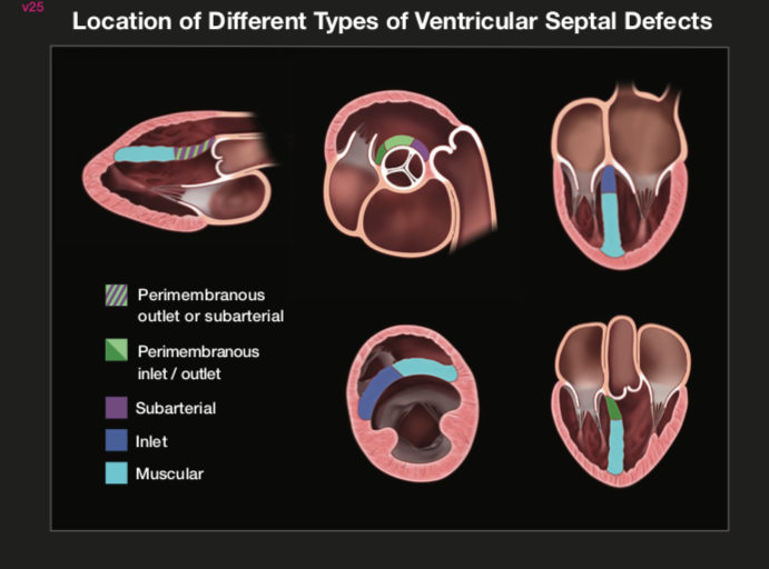 Roberto M Lang (@robertomlang) on Twitter photo The new ASE formula guide is out! It includes ultrasound physics formulas, hemodynamics, evaluation of intracardiac pressures, diastology, prosthetic valves, and congenital heart disease. 
Visit ASE Learning Hub in your portal, and learn more here: shorturl.at/kuzM3. The new ASE formula guide is out! It includes ultrasound physics formulas, hemodynamics, evaluation of intracardiac pressures, diastology, prosthetic valves, and congenital heart disease. 
Visit ASE Learning Hub in your portal, and learn more here: shorturl.at/kuzM3.