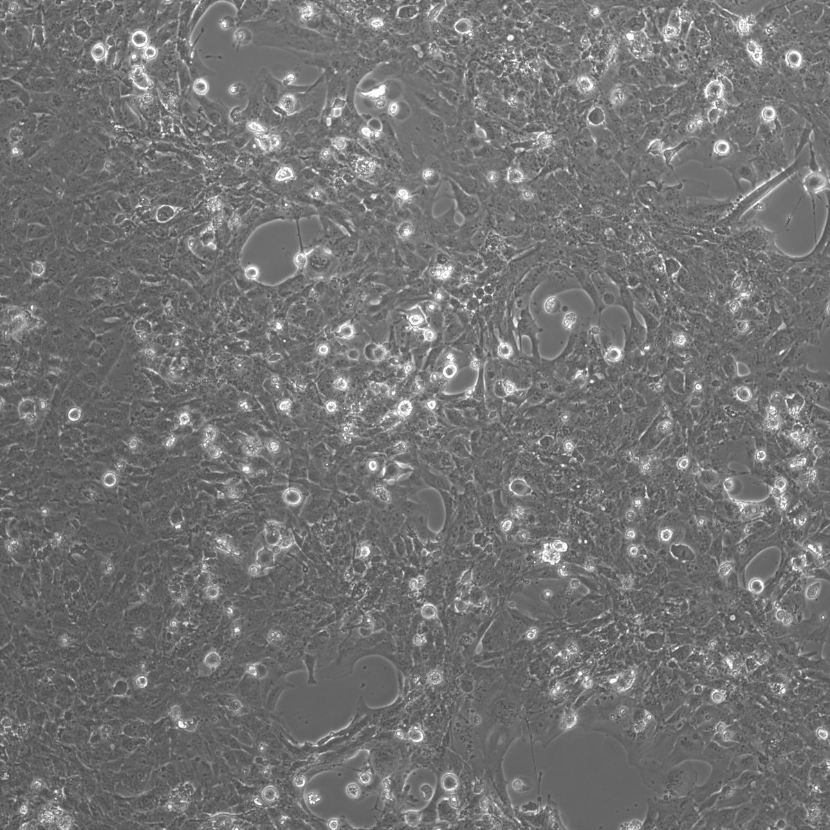 GaborKemenesi's tweet photo. Sorry, I love to share these #Nipah #virus pictures from our #bsl4. HMC3 microglia cells syncytium formation 2DPI https://t.co/1zLBauejMV