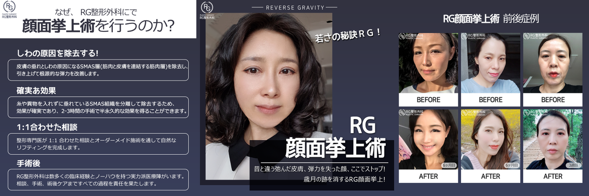 RGplastic's tweet photo. 若い頃に戻りたいあなたに✨
半永久的な施術とは違う
永久的な効果を果たします❣️

お肌の時間を戻したいなら
RG整形外科顔面挙上術💖

🌸韓国国内でも信頼が高く🌸
🍑クチコミ高評価
CCTV安全区❣️透明な病院🍑
👑RG整形外科👑

LINE ID:RG_PS

＃童顔整形　＃RG顔面挙上　＃切開リフトRG https://t.co/h6jJH9F5yC