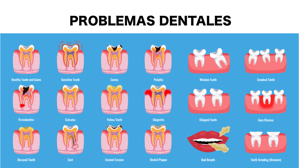 Problemas dentales.
.
.
Hortz arazoak
.
.
#clinicadental #dental #dentista #salud