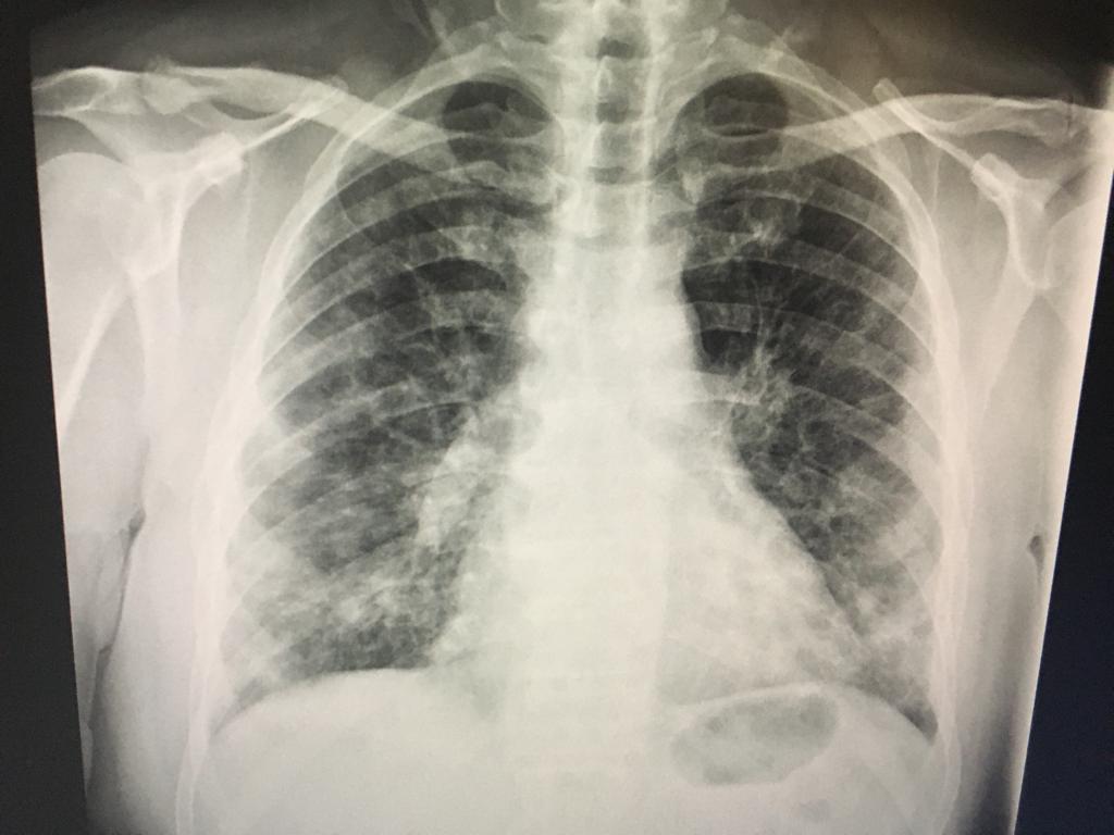 JuanjoArm's tweet image. Esto es el &quot;regalo&quot; de una fiesta de cumpleaños. #mantenladistancia