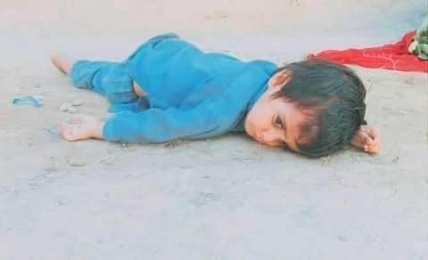 یہ شامی مہاجر نہیں ھے
بلکہ  چمن میں ایف سی کی  بربریت کی تصویر ھے

#PashtoonLivesMatter #StateAttackedChamanSitIn