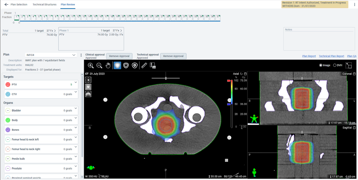 We’ve been using Ethos Treatment Management to generate test plans, QA plans, and the plans of our first clinical patients.