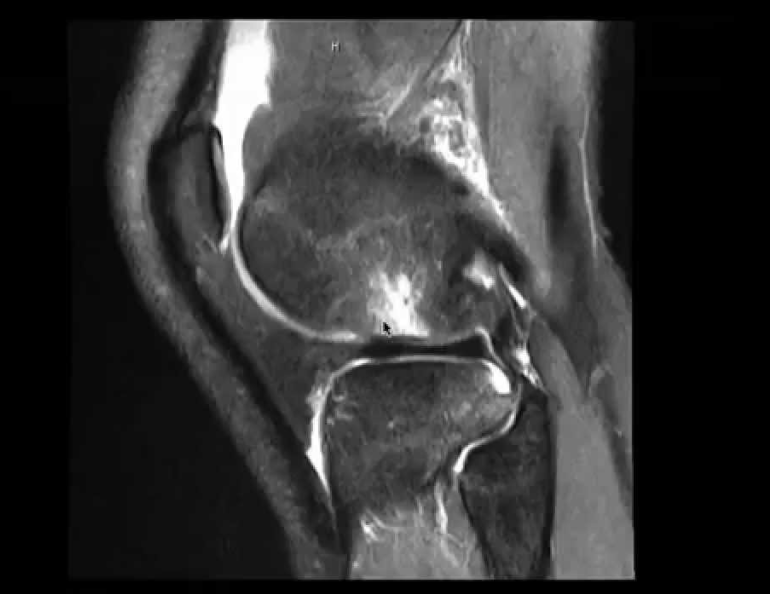 تويتر Garrett Steinmetz Md Steinmetzmd