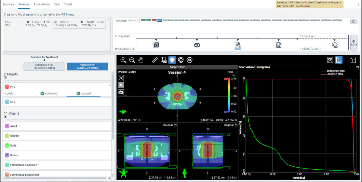 We’ve been using Ethos Treatment Management to generate test plans, QA plans, and the plans of our first clinical patients.