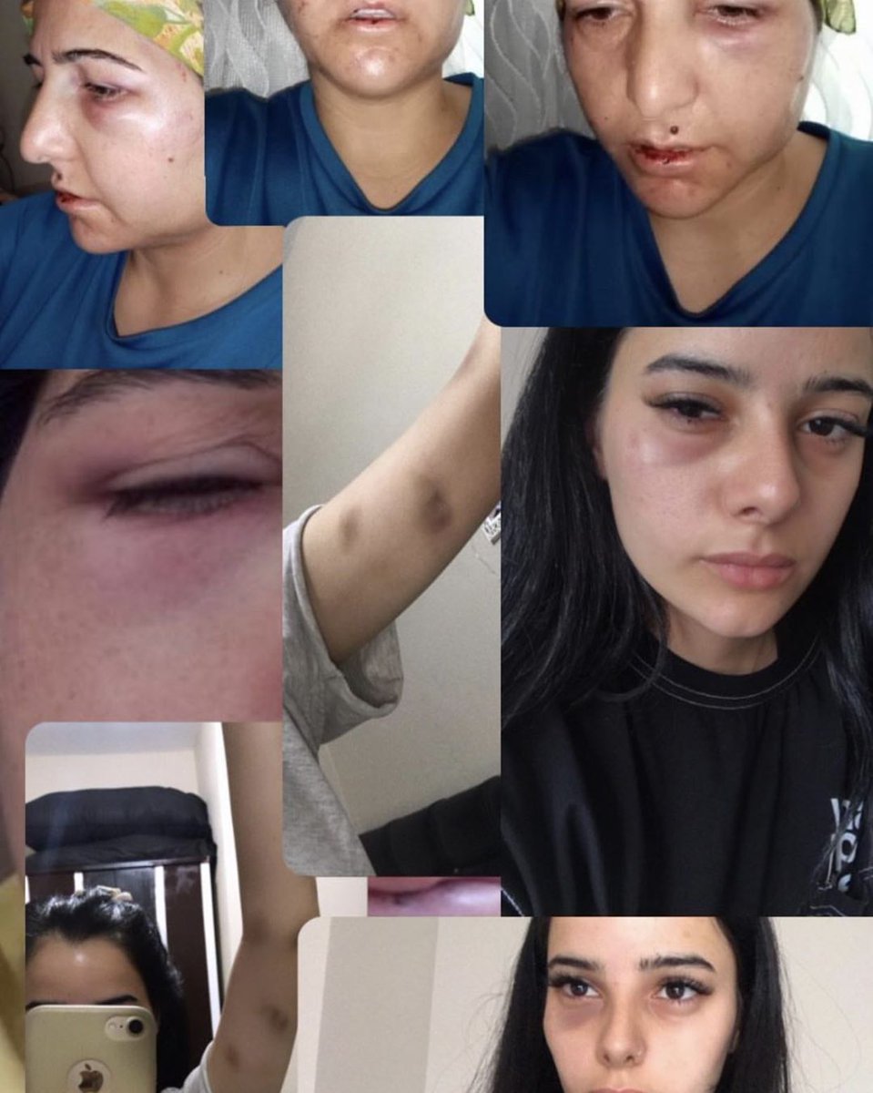 Bir kadın cinayeti daha görmek istemiyor bu gözler lütfen yayalım bir gün sizinde başınıza gelme ihtimalini unutmayalım sesleri olalım <a href="/suleymansoylu/">Süleyman Soylu</a> <a href="/EmniyetGM/">Türk Polis Teşkilatı</a> <a href="/ailevecalisma/">Cshabakanligi</a> #hueseyinbengitutuklansın