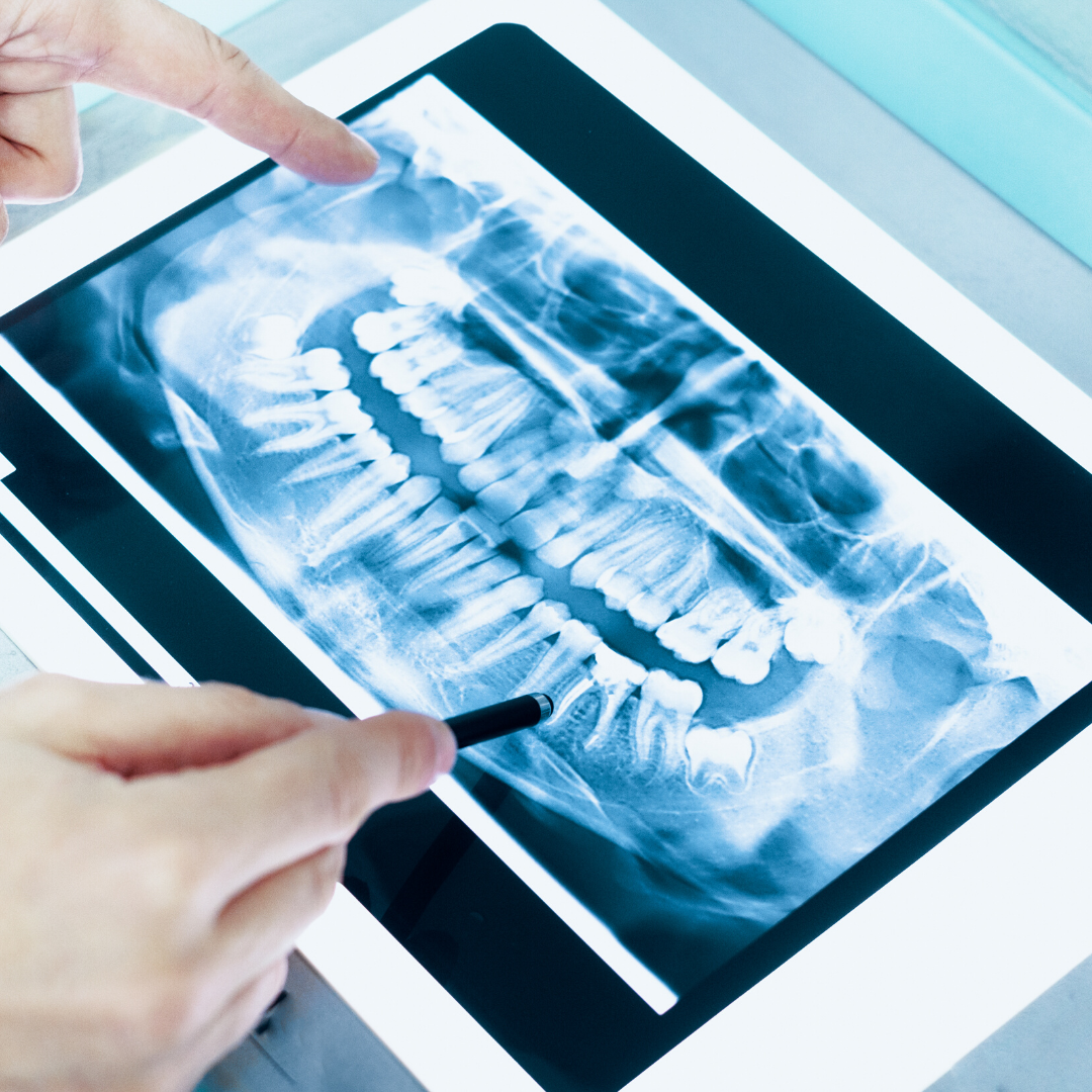 BrennerScottDDS's tweet photo. For the newest dentistry techniques available, with an experienced, gentle dentist, contact the office of Scott Brenner DDS today.  (847) 918-9763 #ScottBrennerDDS #VernonHills #Illinois #DentalCare https://t.co/rgPCYZ6fO6