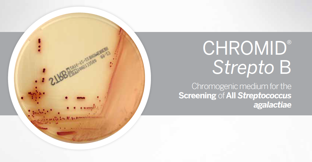 A 2018 study showed that universal #GroupBStrep screening can reduce infection rates by ~80%. CHROMID® Strepto B is the only pre-poured agar that is FDA-cleared for detection of hemolytic and nonhemolytic GBS. Download a reading guide at this link: bit.ly/2EDenZa