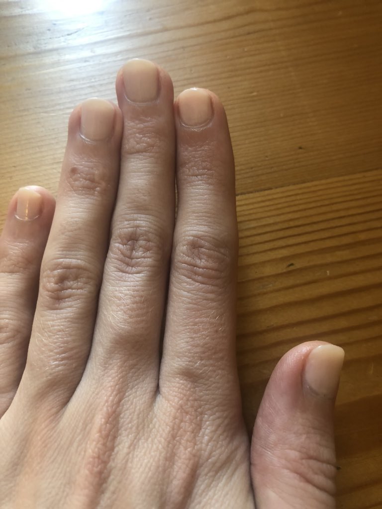 Loving my new nails, painted at <a href="/RemedieRooms16/">REMEDIEBELLES Mobile Beauty & Wellness</a> a #SmallBiz in Streatham and a <a href="/sagegroupplc/">Sage</a> customer #Independentsday. Feeling ready for the sunshine ☀️