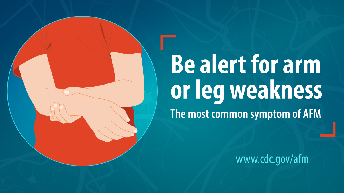 CDCemergency's tweet photo. An outbreak of #AcuteFlaccidMyelitis is anticipated in 2020. Clinicians should be alert for acute limb weakness, especially in children and from August through November. Learn more to be #prepared: https://t.co/ws7kNj6MrV #knowAFM https://t.co/EKphiCH9JS