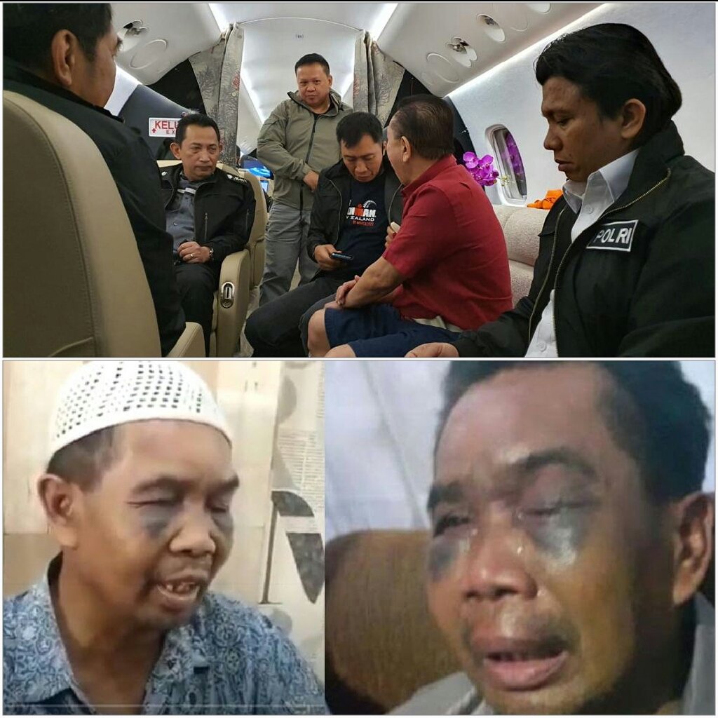podoradong's tweet photo. Foto atas, buronan koruptor yang kabur akhirnya ditangkap kembali

Foto bawah, kuli yang disiksa untuk mengakui perbuatan yang bukan perbuatannya

Beda dunia beda perlakuan

Negara hukum https://t.co/0VsAo78HOk