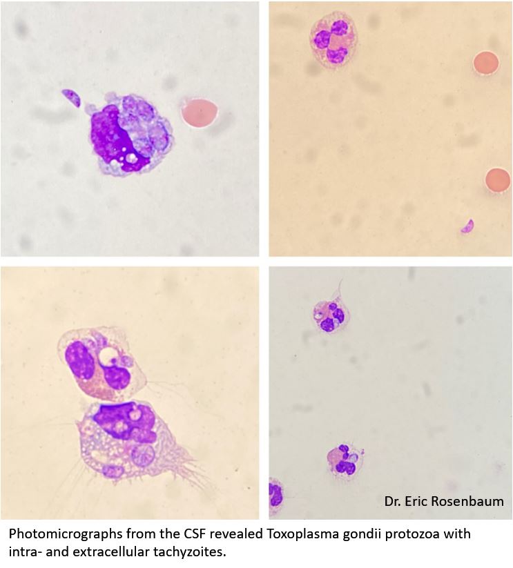 UAMS Hemepath tweet media
