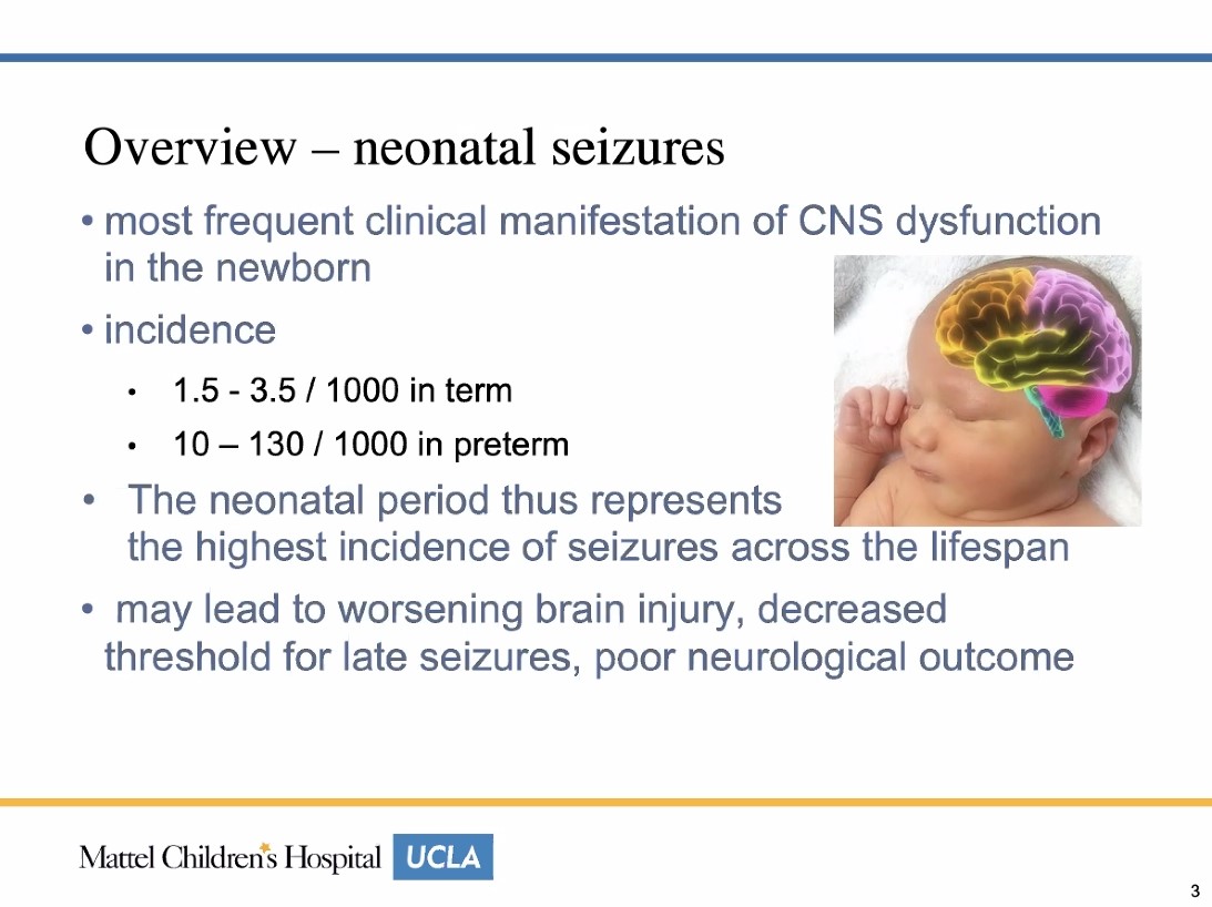 griz1's tweet photo. Fantastic lecture about #neonatalseizures by #DrLRao @uclapedsneuro noon conference #PNNC @UCLAMCH! Keep a cool head. @CNS_Connect @PedNeurBriefs  @AmEpilepsySoc @IlaeWeb @TeenEpilepsyDoc @PedsEpilepsyDoc @NeoToday @DrV_NeoMD #PedsICU #GizaPedNeuro #neonatalneurology https://t.co/Xgb5fqZge0