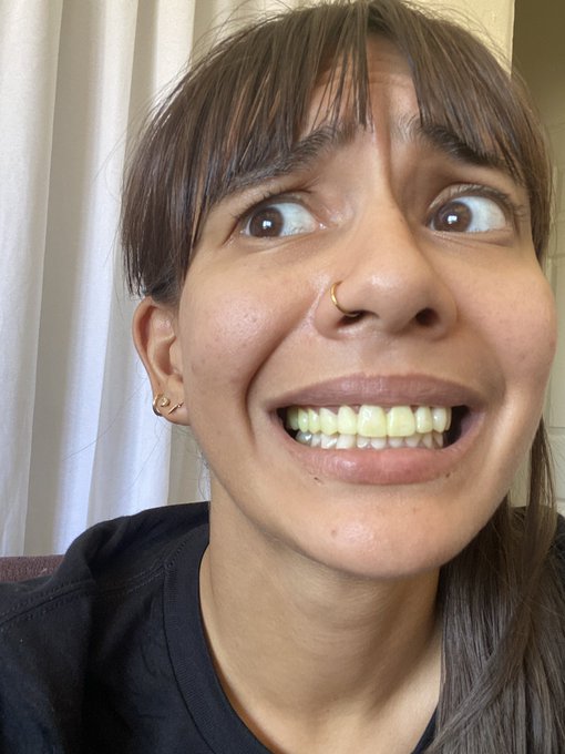 drank a green juice n it stained my temp veneers kms https://t.co/Z0l8F2NGf9